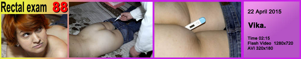 Rectal exam 88.